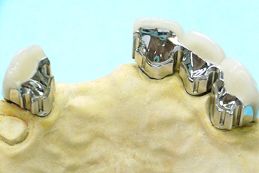 CSP テレスコープ