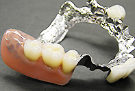 上下MB CSP＋フリクションピン テレスコープ