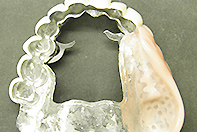 上顎リーゲル下顎CSPリーゲルテレスコープ