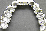 上顎コーヌス下顎フリクションピン＋アンカーバンドテレスコープ