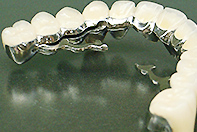 内冠3ユニット リーゲルテレスコープ