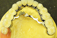 上下 リーゲルテレスコープ