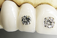 上顎こんなこともできます！