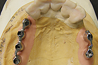 上下MB リーゲルテレスコープ