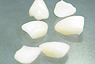 ラミネートベニア