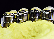 アタッチメント　Co-Crアンカーアタッチメント+コンビロックアタッチメント