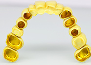 エレクトロホーミング　ZR.Co-Cr内冠