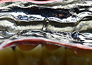 インプラント　フリクションピン付きフルチタン上部構造(Synocta1.5）